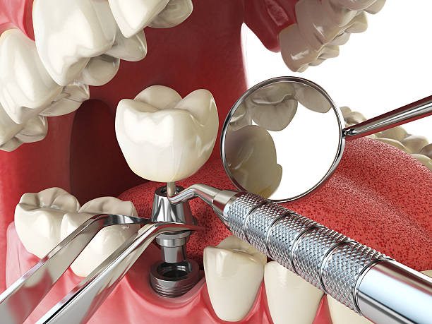 Best 24-Hour Emergency Dental Care in Richland, GA